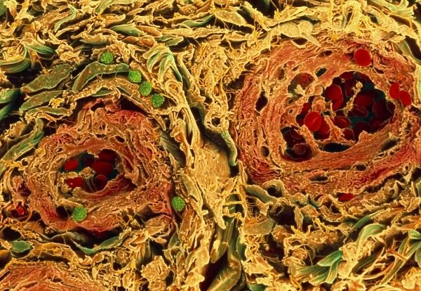 Coloured SEM of blood vessels in the skin