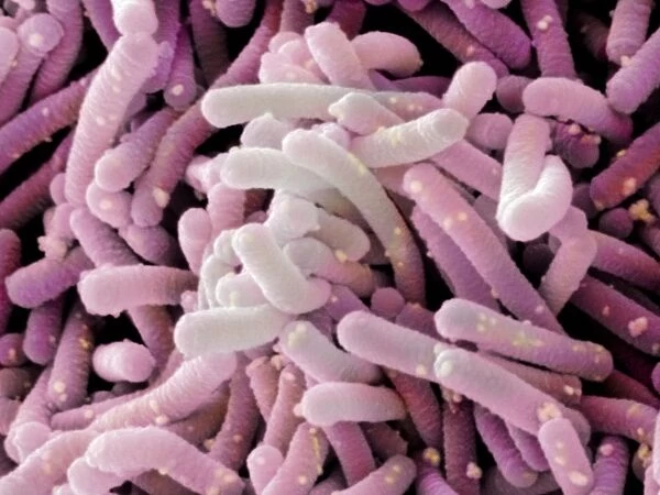 Lactobacillus casei shirota (SEM)