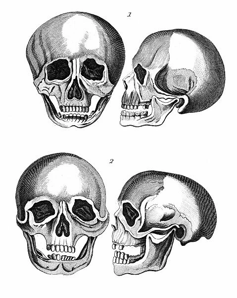 1: Germanic skull with all the marks of a European head. 2: African skull: The arching