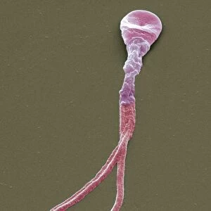 Deformed sperm cell, SEM
