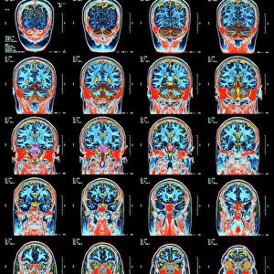Healthy brain, MRI scans