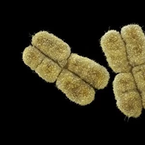 Human chromosomes Pair No. 3 SEM