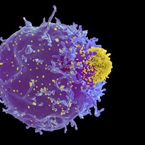 Mouse leukaemia virus and T-cell, SEM C017 / 8308