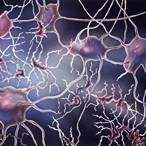 Nerve cell degeneration, artwork