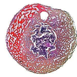 Spongy bone, light micrograph