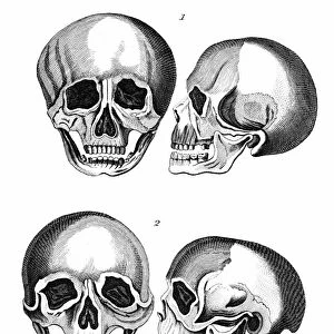 1: Germanic skull with all the marks of a European head. 2: African skull: The arching
