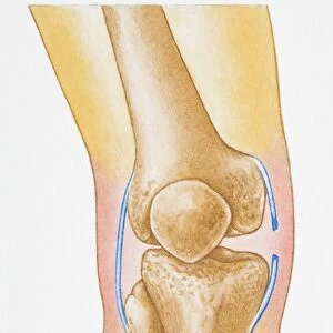 Illustration showing torn human knee ligament