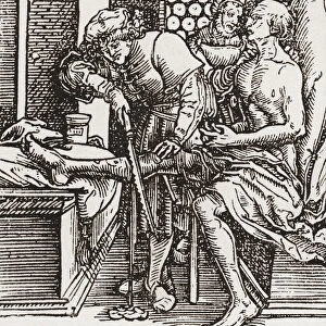 A Physician Performing An Amputation During The Tudor Period In England. From A Contemporary Print